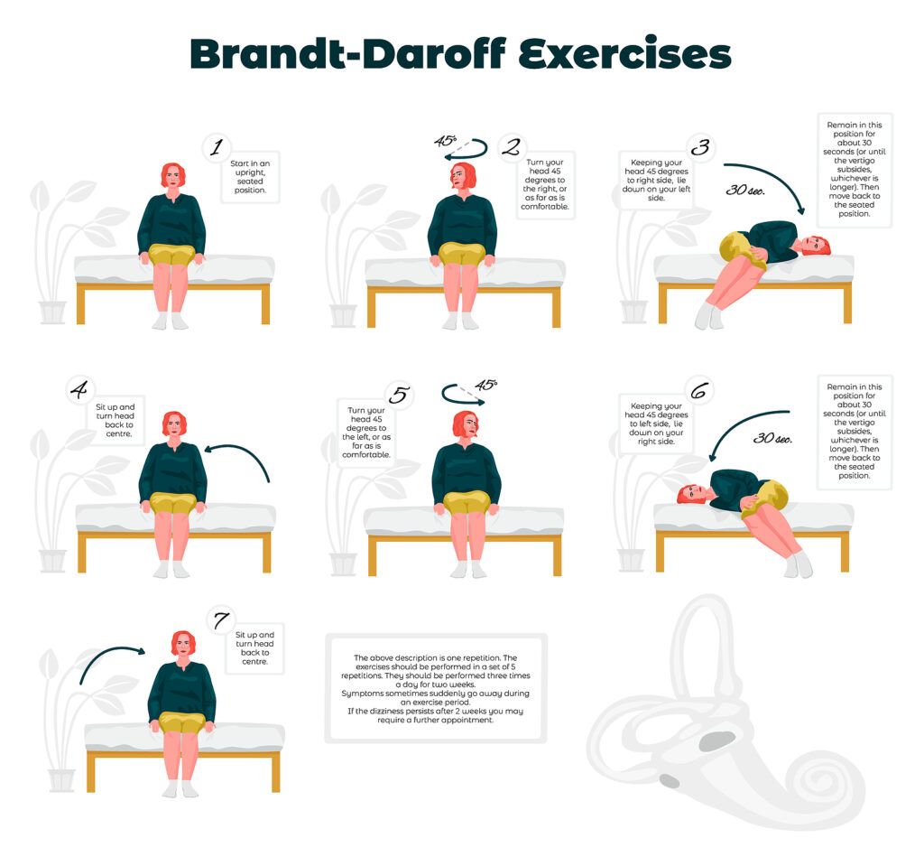 brandt daroff exercises for bppv