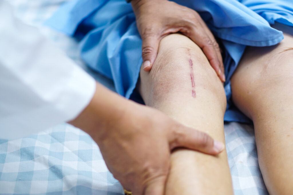 knee replacement recovery